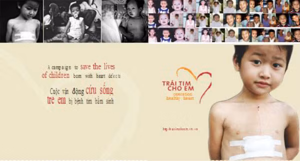 Vietnamitas en Rusia realizan programa caritativo a favor de niños con enfermedades cardíacas ảnh 1 Vietnamitas en Rusia realizan programa caritativo a favor de niños con enfermedades cardíacas ảnh 1