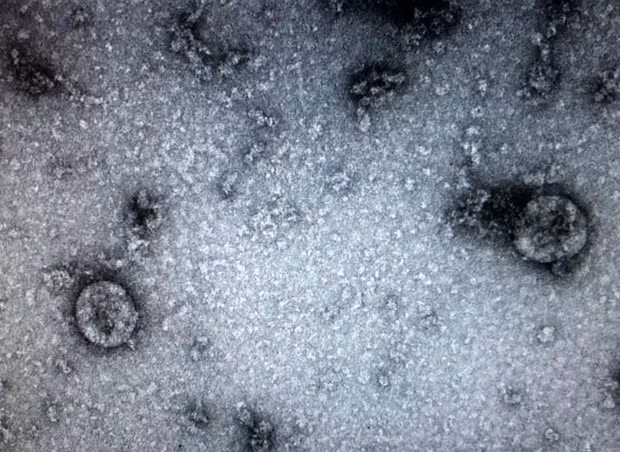 Vietnam tiene suficientes biofármacos para realizar análisis de COVID-19, según funcionario ảnh 1