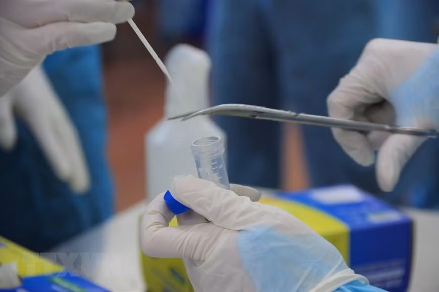 Amanece Vietnam con 92 casos nuevos del COVID-19 ảnh 1