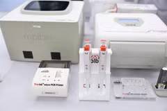 Estados Unidos dona máquina de diagnóstico rápido de tuberculosis a Vietnam