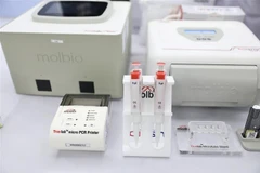 Estados Unidos dona máquina de diagnóstico rápido de tuberculosis a Vietnam