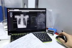 Abogan por intensificar participación de jóvenes vietnamitas en lucha contra tuberculosis