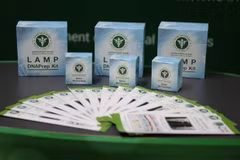 Tailandia producirá kit de prueba de tuberculosis