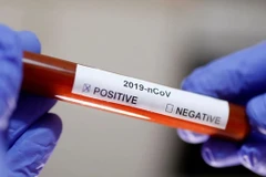 Aumentan a 49 casos infectados de coronavirus en Vietnam 