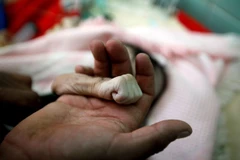 Vietnam exhorta a establecer la paz y luchar contra el hambre en Yemen