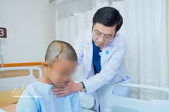 El doctor Truong Thanh Tinh, jefe del Departamento de Neurocirugía del Hospital de la Universidad de Medicina y Farmacia de Ciudad Ho Chi Minh, realiza la evaluación postoperatoria del paciente pediátrico tras la intervención. (Foto: VNA)