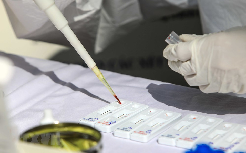 Se conservan cuidadosamente muestras de sangre (Foto: VNA)