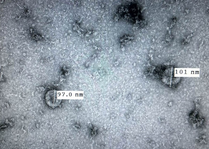 El Instituto Nacional de Higiene y Epidemiología de Vietnam desarrolló con éxito en febrero de 2020 una versión cultivada en laboratorio del nuevo coronavirus para conducir estudios que allanen su tratamiento. Esta es la premisa para la investigación y desarrollo de vacunas contra el COVID-19. (Fuente: VNA)