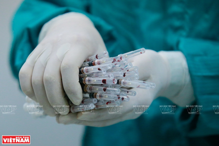 Muestras para nuevos estudios sobre vacunas (Foto: VNA)