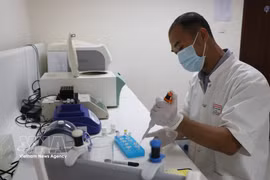 El doctor Nguyen Duc Bach, miembro del Consejo Científico del Hospital Central de Hue, es quien sentó las primeras bases y contribuyó gradualmente al perfeccionamiento de los recursos humanos y del sistema de análisis clínicos del hospital. (Fuente: VNA)