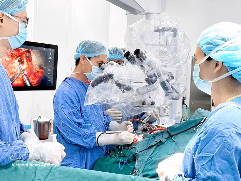 Los médicos realizan una cirugía cerebral a un paciente. (Foto: VNA)