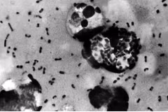 La bacteria Yersinia pestis causa la peste. Foto: Centros para el Control y la Prevención de Enfermedades de EE. UU.