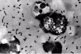 La bacteria Yersinia pestis causa la peste. Foto: Centros para el Control y la Prevención de Enfermedades de EE. UU.
