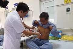  Destacan resultados de Vietnam en la lucha contra la tuberculosis