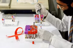 Vietnam se empeña en ampliar tratamiento antirretroviral para pacientes con VIH/SIDA