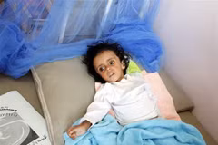 Exhorta Vietnam a combatir el hambre en Yemen