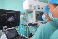 El equipo de médicos del Hospital Central de Hue dirige la realización de un trasplante de órganos procedentes de un donante con muerte cerebral en el Hospital Vietnam-Suecia en Uong Bi, provincia de Quang Ninh. (Fuente: VNA)