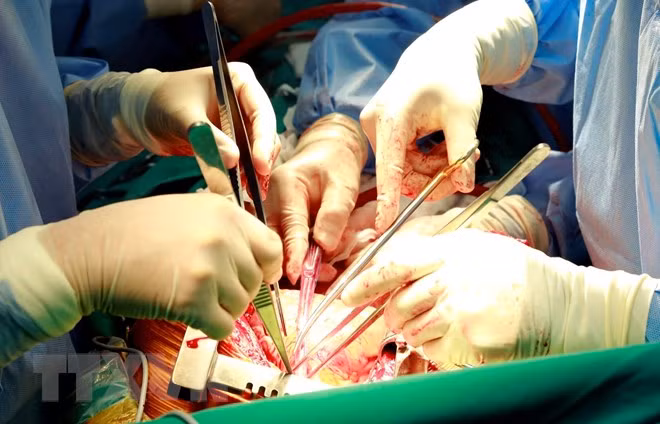 Hospital vietnamita realiza con éxito cirugía para el cáncer de tiroides ảnh 1