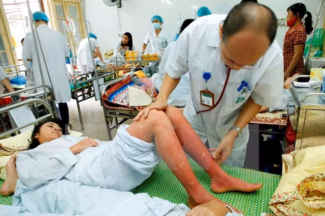 Vietnam busca reducir tasa de mortalidad por dengue ảnh 1 Vietnam busca reducir tasa de mortalidad por dengue ảnh 1