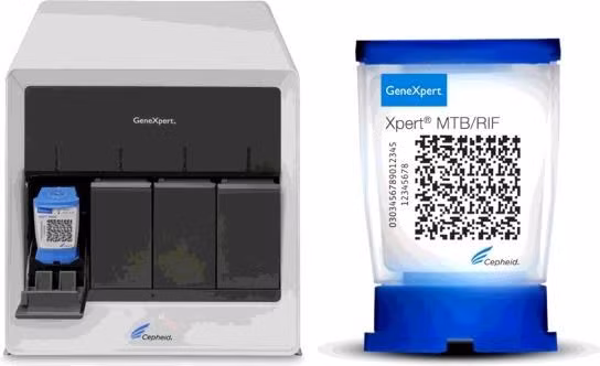 Vietnam por emplear sistema de prueba de tuberculosis en detección del coronavirus ảnh 1 Vietnam por emplear sistema de prueba de tuberculosis en detección del coronavirus ảnh 1