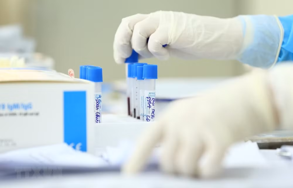 Confirma Hanoi 61 nuevos contagios del COVID-19 ảnh 1