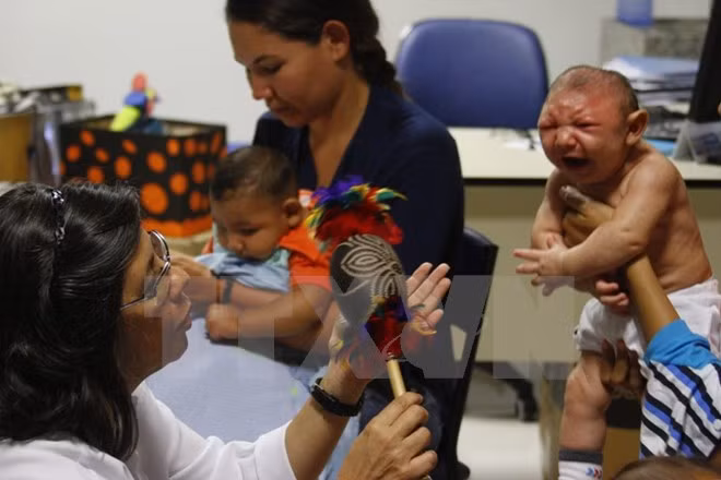 Zika causa microcefalia, según expertos estadounidenses ảnh 1
