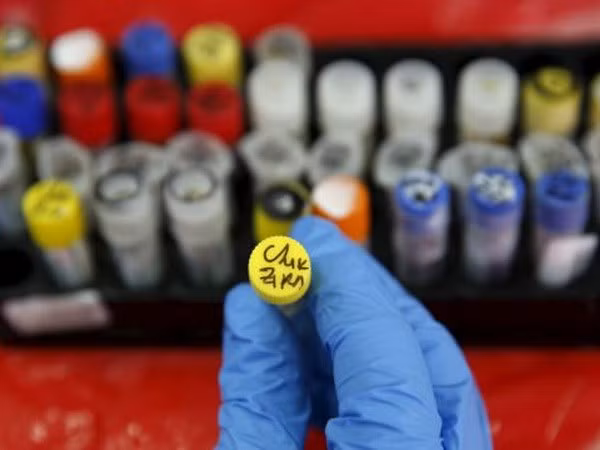 Ministerio de Salud recomienda autoprotección contra dengue y virus Zika ảnh 1