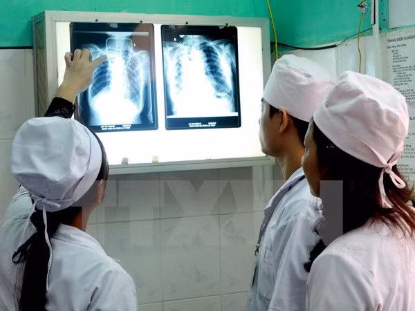 Despliegan en Vietnam programa contra brote de tuberculosis ảnh 1