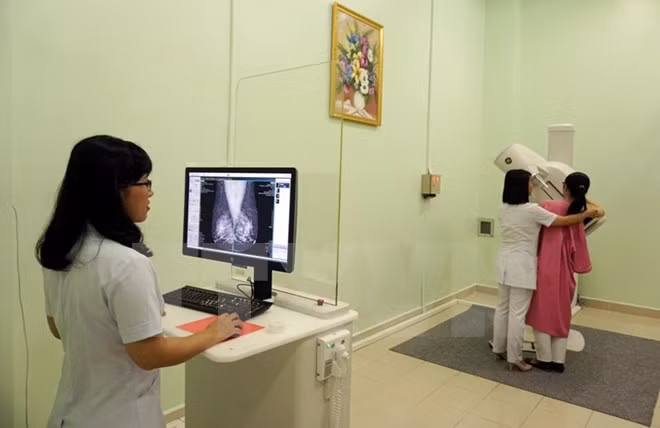 Sufren mujeres vietnamitas de cáncer de mama con edad cada vez más temprana ảnh 1 Sufren mujeres vietnamitas de cáncer de mama con edad cada vez más temprana ảnh 1