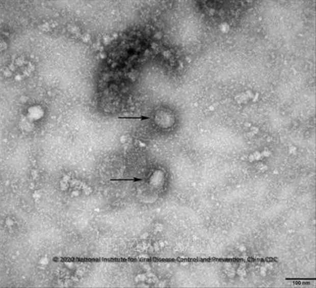 Implementan Indonesia y Corea del Sur medidas preventivas contra nuevo coronavirus ảnh 1