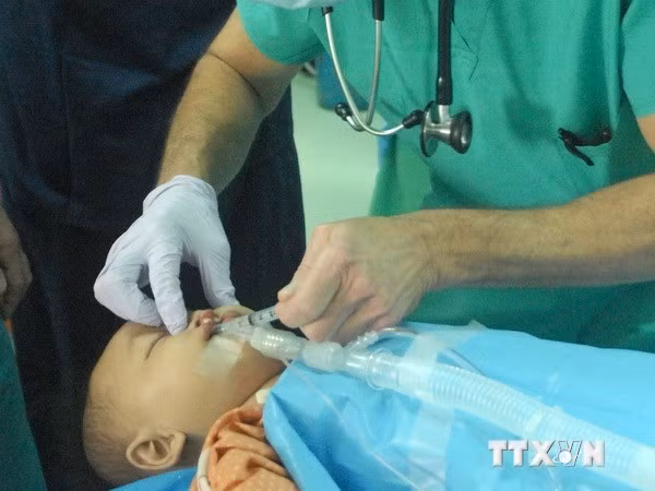 Programa devuelve sonrisa a niños con defectos labiales ảnh 1
