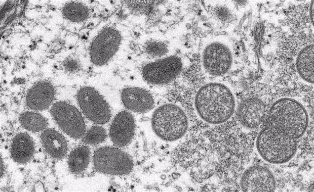 Ciudad Ho Chi Minh detecta segundo caso de viruela del mono ảnh 1