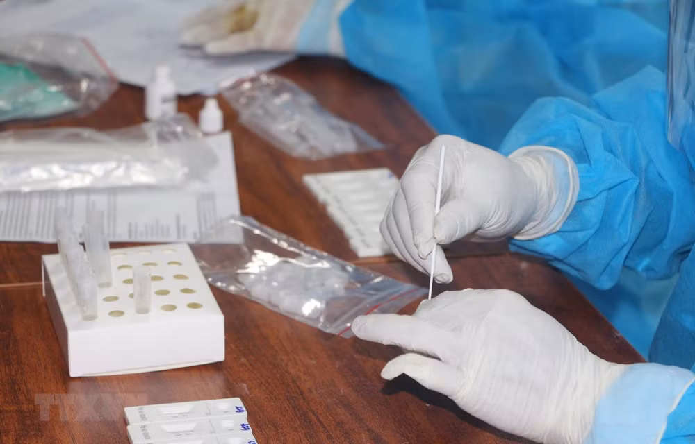Vietnam confirma más de 24 mil 600 nuevos casos de COVID-19 ảnh 1