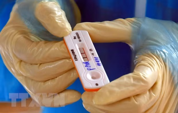 Disminuye cifra de infectados de COVID-19 en Vietnam ảnh 1