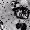 La bacteria Yersinia pestis causa la peste. Foto: Centros para el Control y la Prevención de Enfermedades de EE. UU.